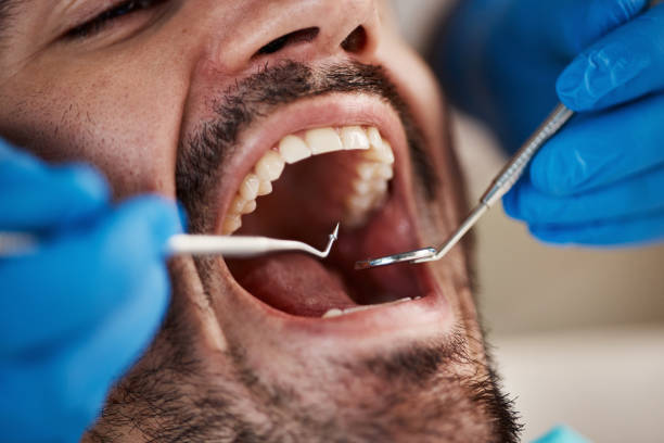 Best Emergency Denture Repair in Overland Park, KS